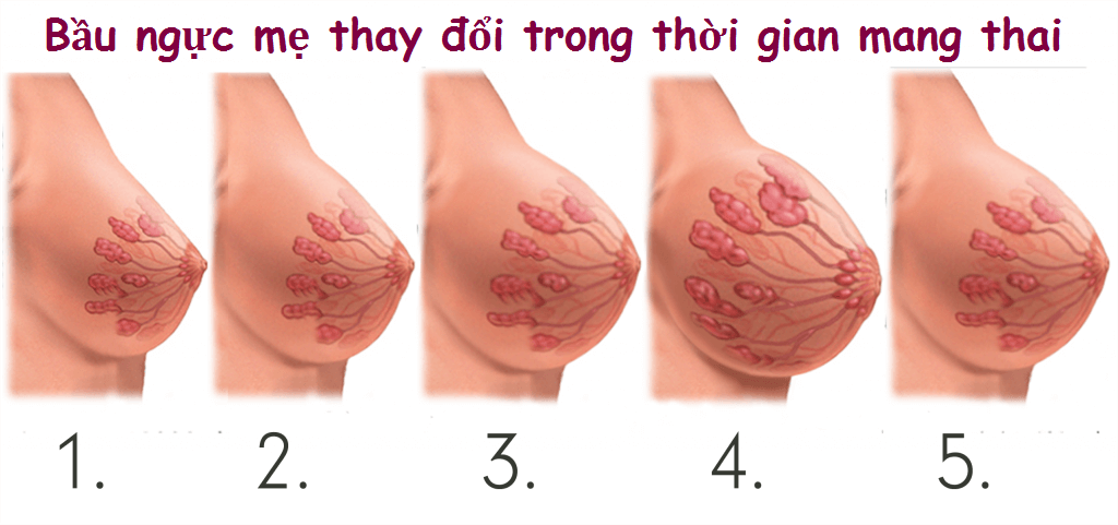 99+ Hình Ảnh Nhũ Hoa Khi Mới Mang Thai, thay đổi trông thấy