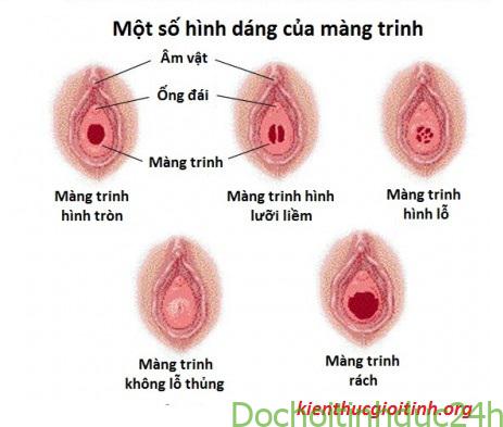 hạt giống