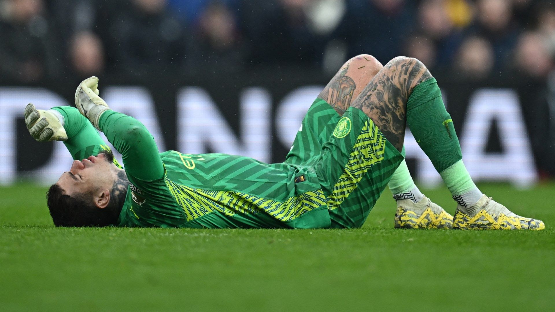Thất bại của Brazil! Thủ môn Ederson bị loại khỏi đội hình Copa America 2024 vì chấn thương mắt | Goal.com Việt Nam